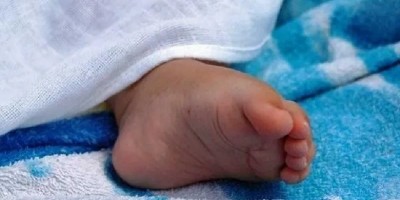Dokter Kandungan Diduga Lalai, Bayi Malang Ini Lahir Tanpa Hidung Dan Mata