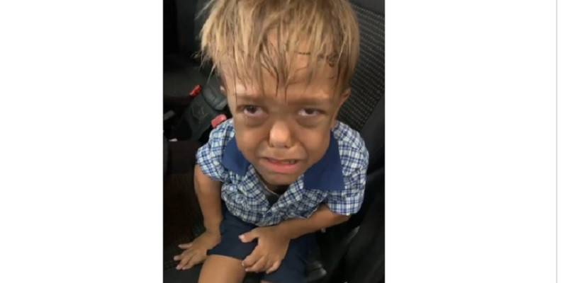 Bocah 9 tahun, Quaden Bayles saat menangis karena menjadi korban bullying/Net
