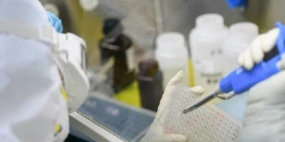 Harapan Baru, AS Mulai Ujicoba Kandidat Vaksin Virus Corona Kepada Manusia