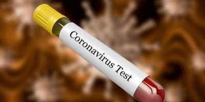 Segini Biaya Tes Coronavirus Di Rumah Sakit