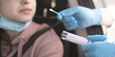BPKP Usulkan Harga Tes Swab Rp 700 Ribu, Segini Kisaran Harga di Rumah Sakit