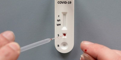 Mengenal Swab Antigen, Rapid Test, dan PCR. Mana Yang Lebih Akurat?