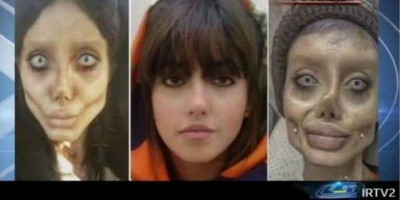 Sempat Tenar Gara-gara Ngaku Gagal Operasi Mirip Angelina Jolie, Selegram Ini Harus Meringkuk 10 Tahun Di Penjara Karena Ulahnya