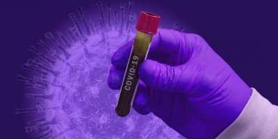 Mencari Outliers Covid-19 Untuk Menemukan Kelemahan Mematikan Virus Corona