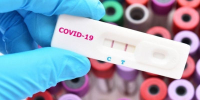 Kasus 'Covid Berkelanjutan', Pria Inggris Positif Terinfeksi Virus Corona Selama 10 Bulan