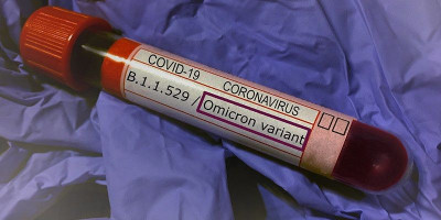  Mengacu Flu Spanyol, Pakar Nilai Omicron Pertanda Akhir dari Pandemi Covid-19