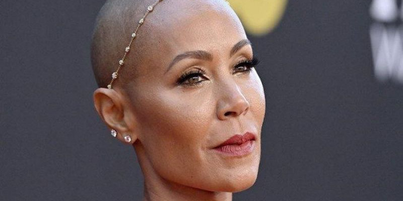 Istri Will Smith, Jada Pinkett Smith, yang menderita penyakit alopecia/ Net


