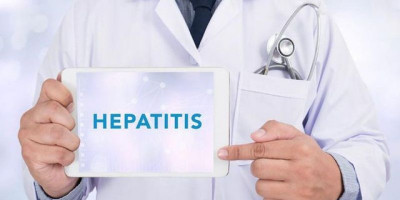 Hepatitis Akut Bisa Disembuhkan, Perhatikan Hal-hal Berikut Ini 