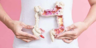 Kabar Baik! Kemenkes dan Bio Farma Perkenalkan Alat Deteksi Kanker Usus