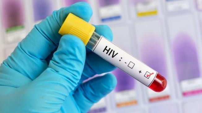 Ahli sedang melakukan ujiklinis vaksin HIV berbasis mRNA/Net