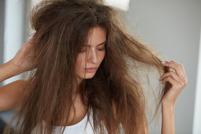 Tidak hanya acak-acakan, tidur dengan rambut basah juga memicu tumbuhnya jamur/Net