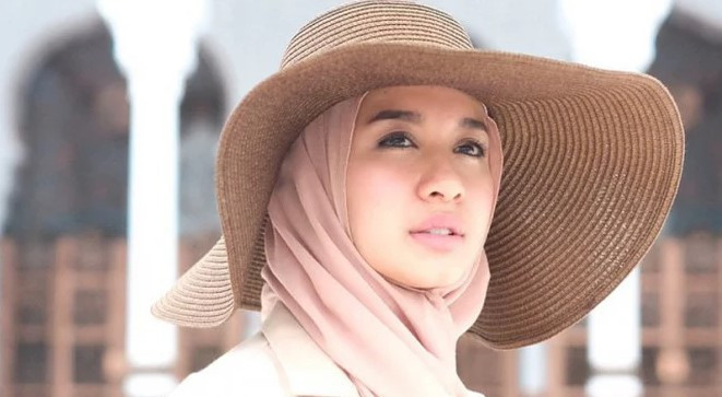 Salah satucontoh kulit sehat dimiliki oleh Laudya Cynthia Bella/Net