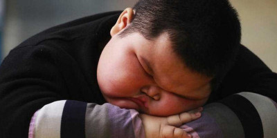Anak Gendut atau Obesitas? Kenali Cirinya Yuk, Bunda!