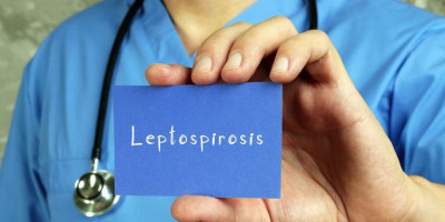 Gejala Flu Leptospirosis Bisa Mengancam Jiwa, Kenali Gejalanya 