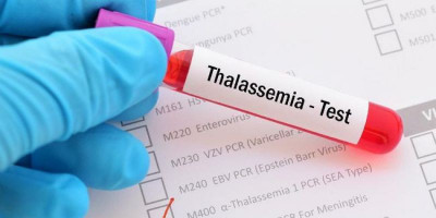 Kisah Pasangan Pembawa Gen Thalassemia Memilih Berpisah Demi Melahirkan Keturunan yang Sehat