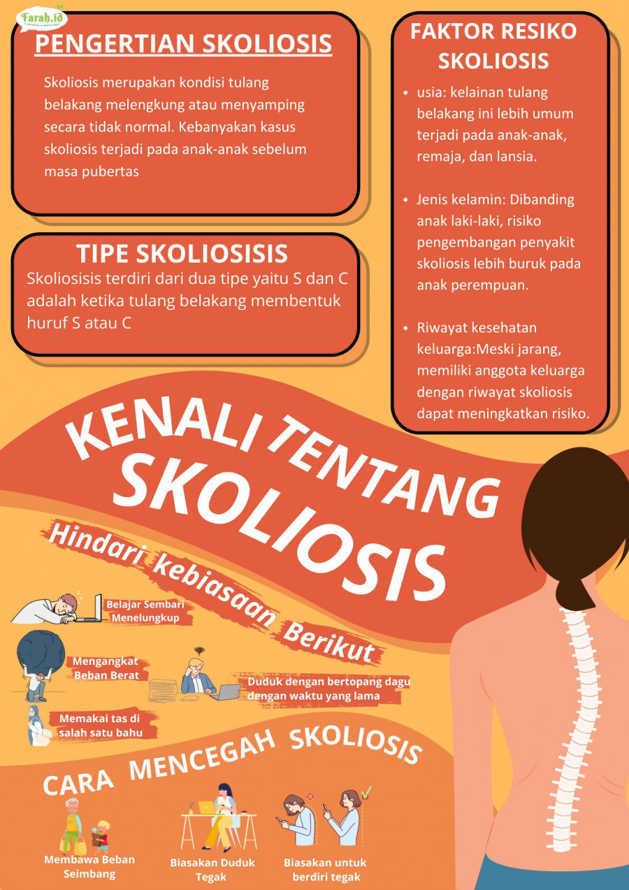 Skoliosis adalah penyakit kelainan tulang yang dapat menimpa anak baru lahir hingga orang dewasa/Dewi Farah