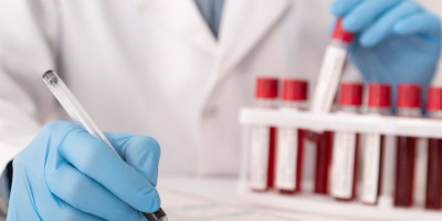 Pertama di Dunia, Rumah Sakit di China Temukan Genetik Baru Subtipe Golongan Darah P yang Langka