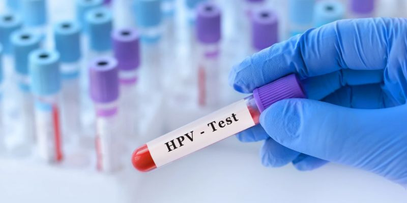 Urgensi vaksinasi HPV/Canva