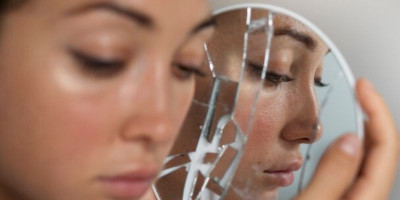 Alami Masalah Kulit Akibat Salah Pilih <i>Skincare</i>, Lakukan 7 Langkah Ini Agar Kulit Kembali Sehat
