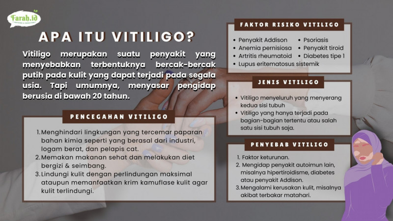 Mengenal vitiligo/Infografis: Timur Muhammad Santosa