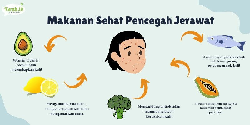Apa saja makanan yang bisa bantu cegah datangnya jerawat?/Infografis: Nurfildzah Amalina