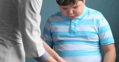 Ahli Sebut MPASI Dini Mempengaruhi Obesitas pada Anak