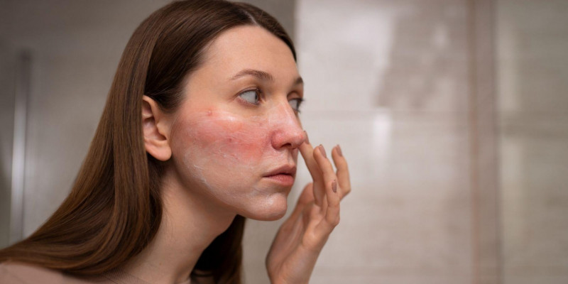 Ilustrasi perempuan dengan kulit sensitif sedang memakai skincare. (Freepik)
