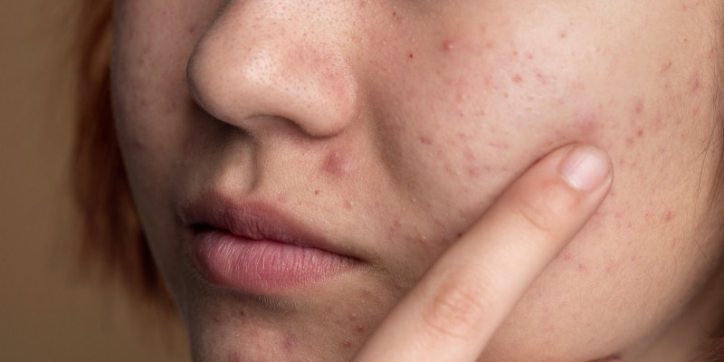 Ilustrasi wajah rusak. (Freepik)